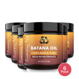 Sunny Isle 100% Raw & Pure Batana Oil 4oz (Pack of 6)