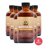 Sunny Isle Anti-Thinning Batana Oil Infused with Jamaican Black Castor Oil 4oz (Pack of 6)