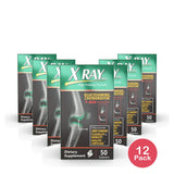 X Ray Dol Glucosamine Chondroitin + MSM 50 Count (Pack of 12)